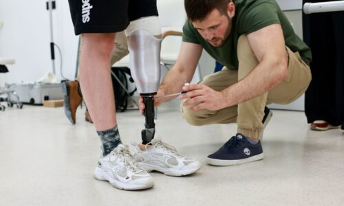 Modelling of prosthetic limbs: From 3D Scan to Prosthesis | Протезування: від 3D-сканування до готового протеза